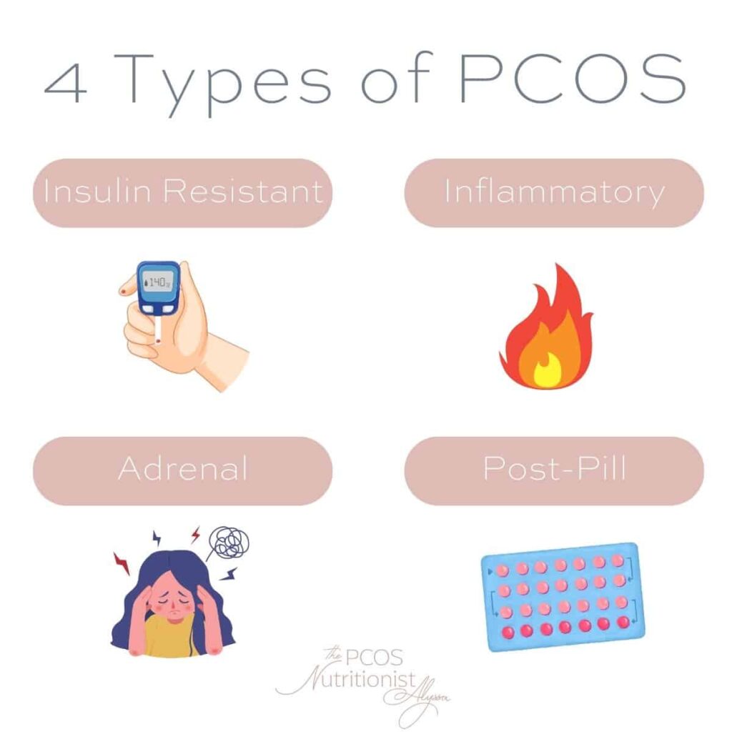 infographic on the 4 types of pcos.